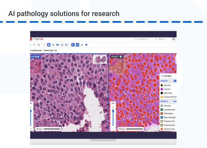 AI pathology solutions for research - How AI Is Improving Medical Diagnostics and Disease Detection